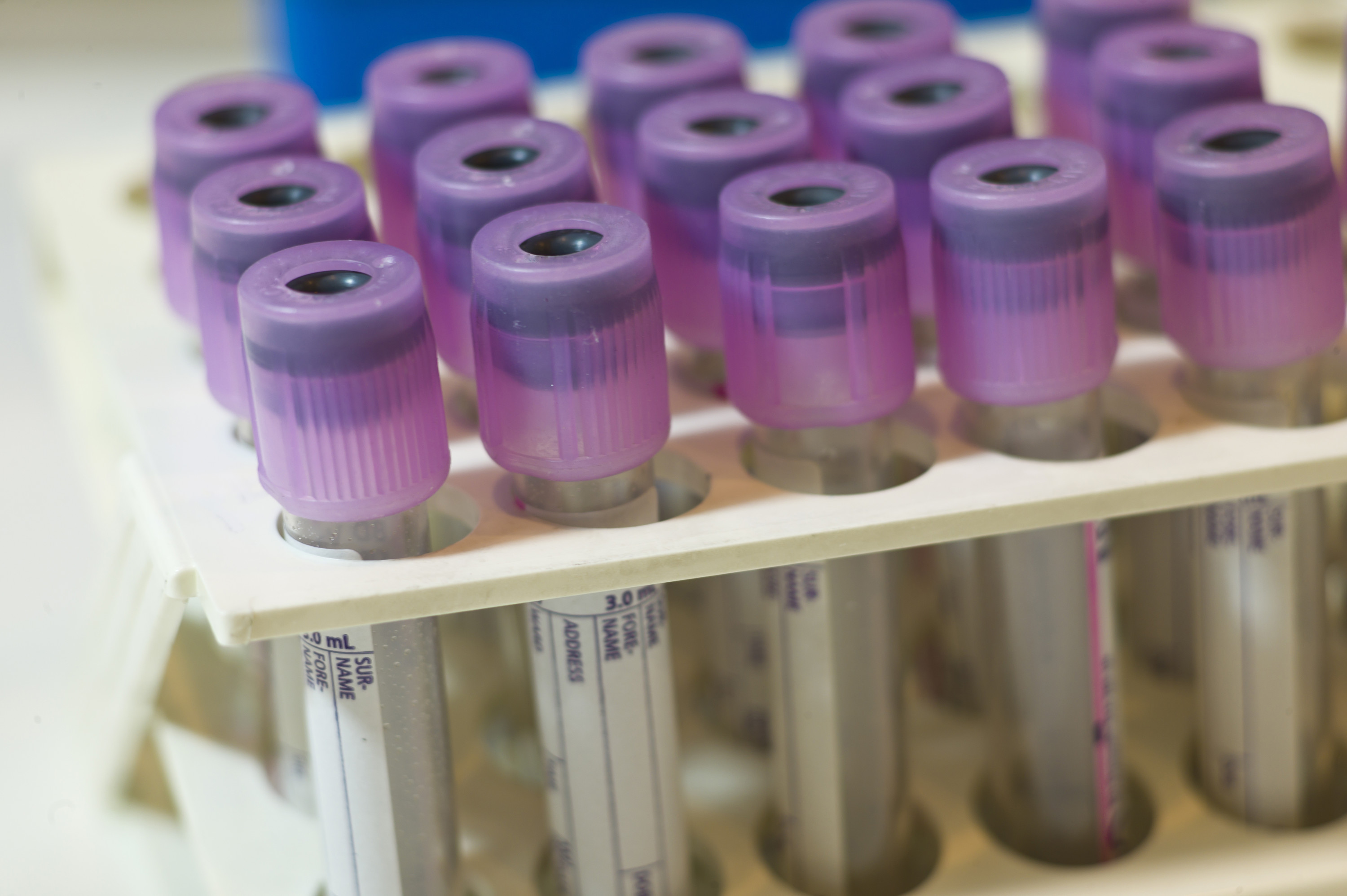 A Blood Test For Autism Not So Fast >> Success Of Blood Test For Autism Affirmed News Events A Blood Test For Autism Not So Fast >> Success Of Blood Test For Autism Affirmed News Events